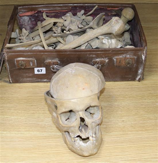 A human skeleton